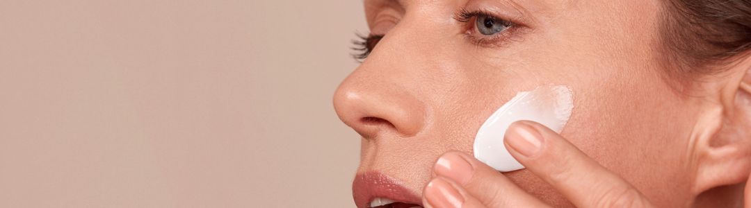 Adult Acne