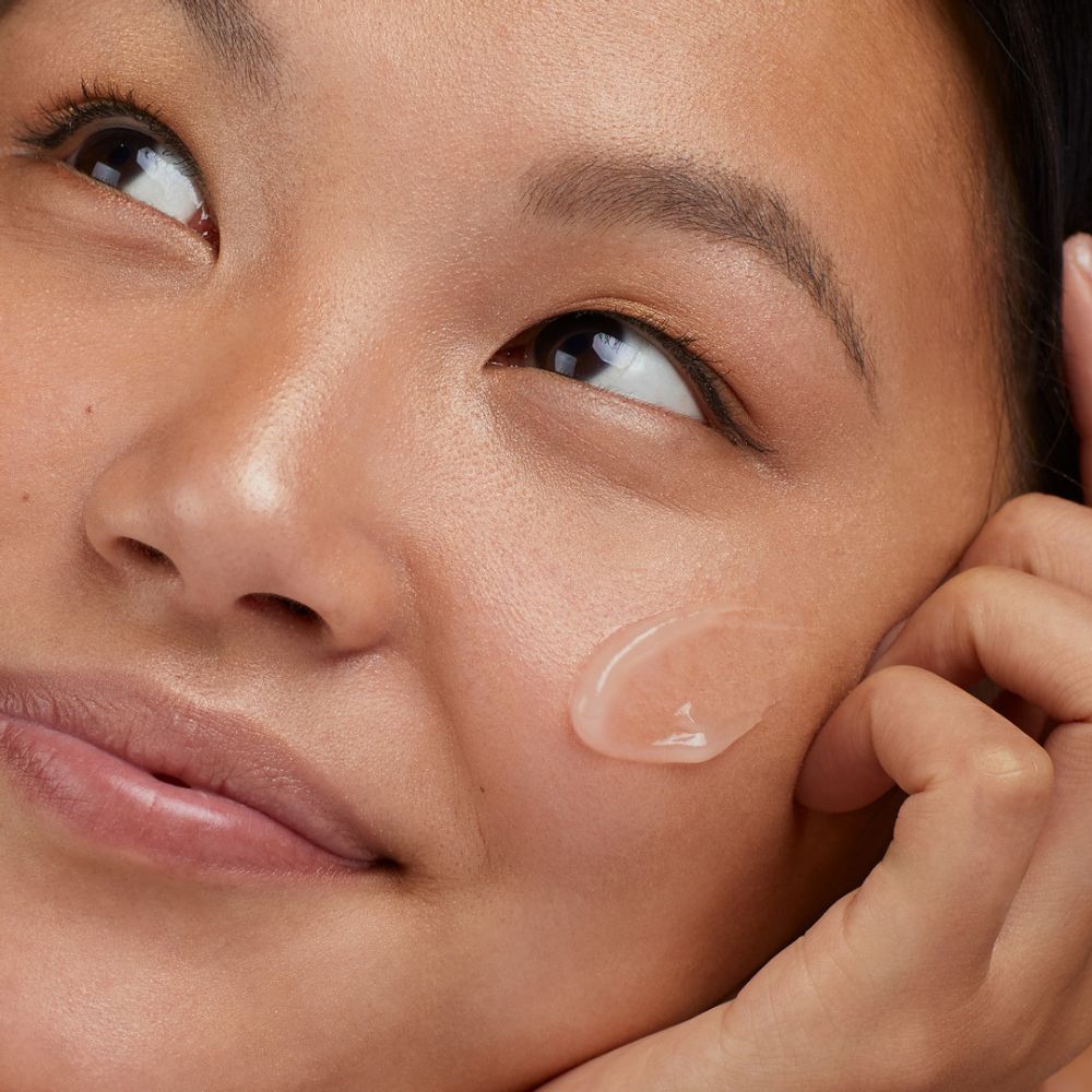 What to Do When You Have Acne and Dry Skin