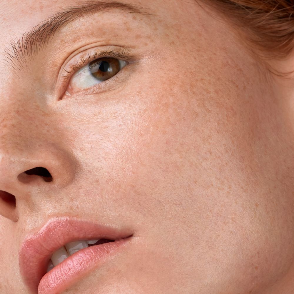 The Best Ways to Treat Acne and Sensitive Skin