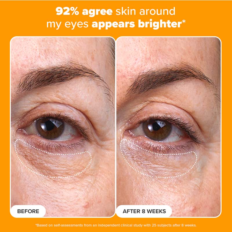 C5 Super Boost Eye Cream