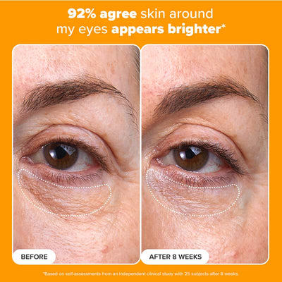 C5 Super Boost Eye Cream