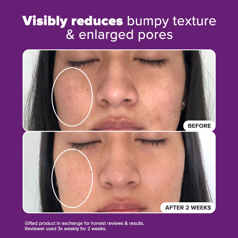 20% Niacinamide Face Serum: Reduce Pore and Smooths Skin | Paula's