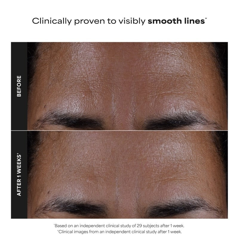2% BHA Liquid Exfoliant