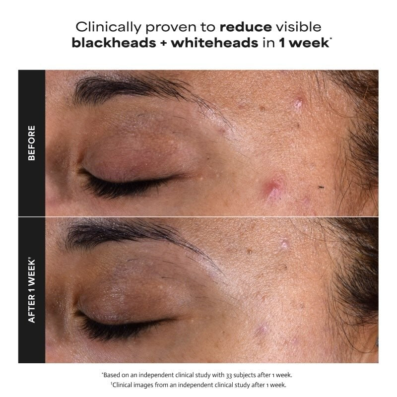 2% BHA Liquid Exfoliant